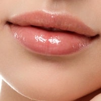 Lip Lines Treatments